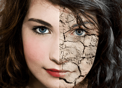 4 Reasons Your Skin is Prematurely Old