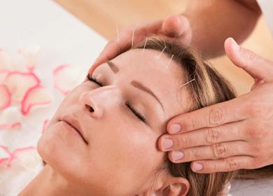 How Acupuncture Helps Migraines