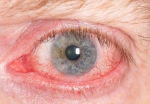 #1 Worst Oil That Promotes Blindness