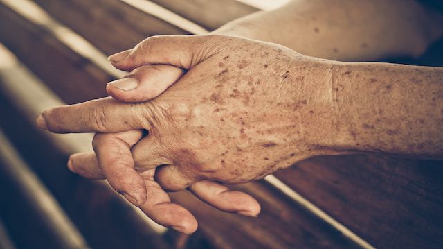 hands of a female elderly full of freckles