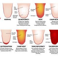 tonguediagram