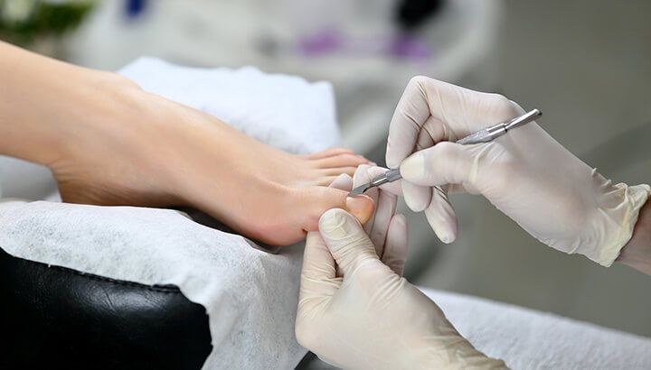 Ingrown toenail remedies cut cuticles