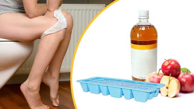 Apple cider vinegar ice cubes for hemorrhoids