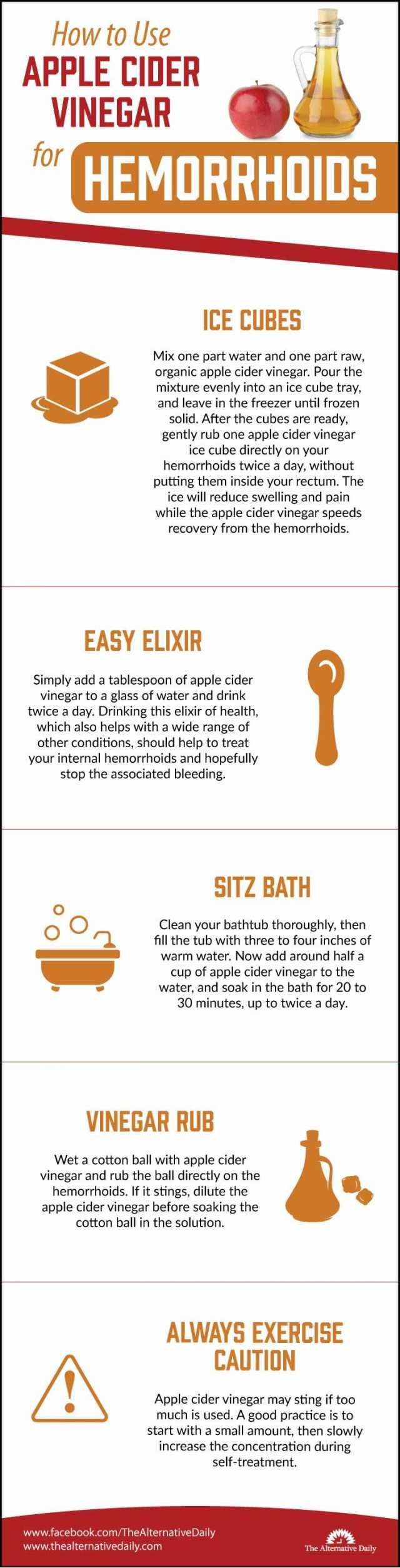 Apple Cider Vinegar Ice Cubes For Hemorrhoids