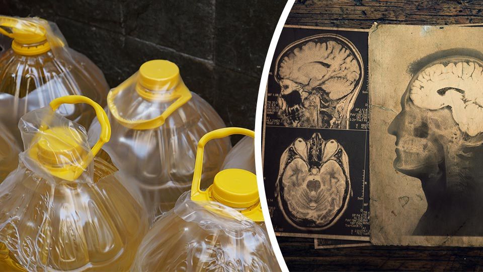 Canola Oil Might Be Bad For Your Memory, Study Finds