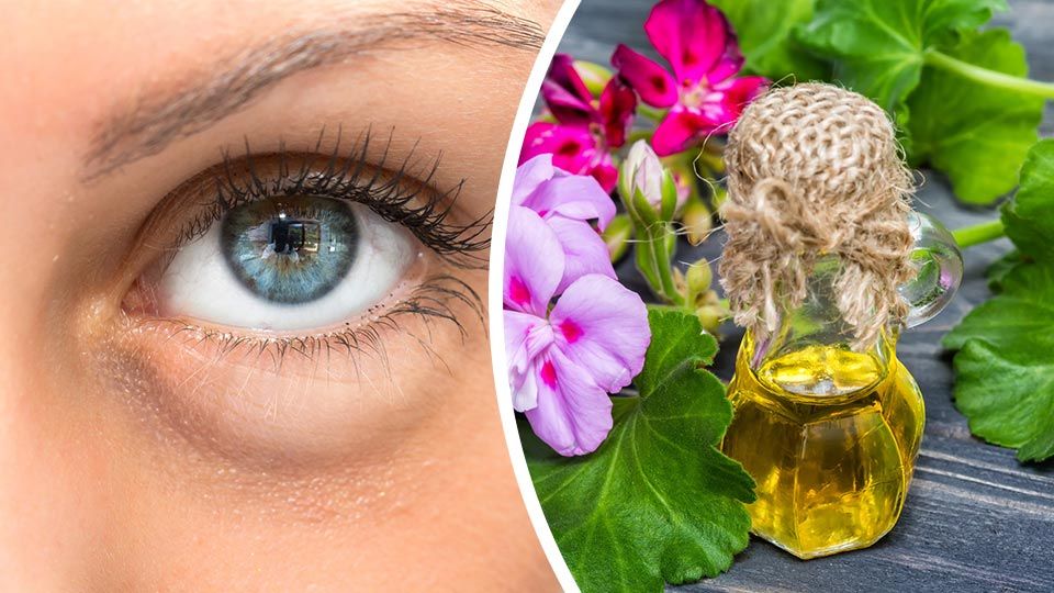 7 Essential Oils To Beat Puffy Eyes (5 Is A MUST Try If You're Having Problems)